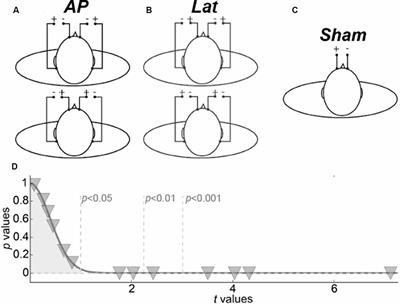 Antero-Posterior vs. Lateral Vestibular Input Processing in Human Visual Cortex